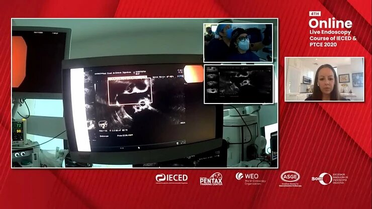 4th online live endoscopy course